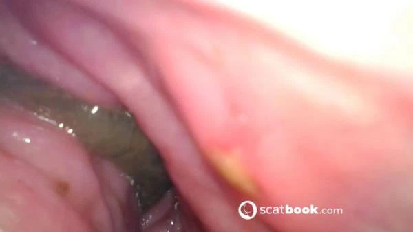 Sweet Tinqerbell - Endoscope In My Ass - Dildo, Anal [FullHD 1080p] (647 MB) Scatbook.com