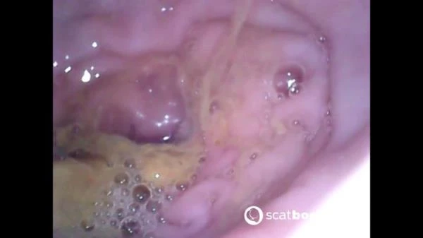 Sweet Tinqerbell - Show Inside Of My Ass With Endoscope - Dildo, Anal [FullHD 1080p] 378 MB